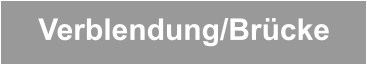 Verblendung/Brücke